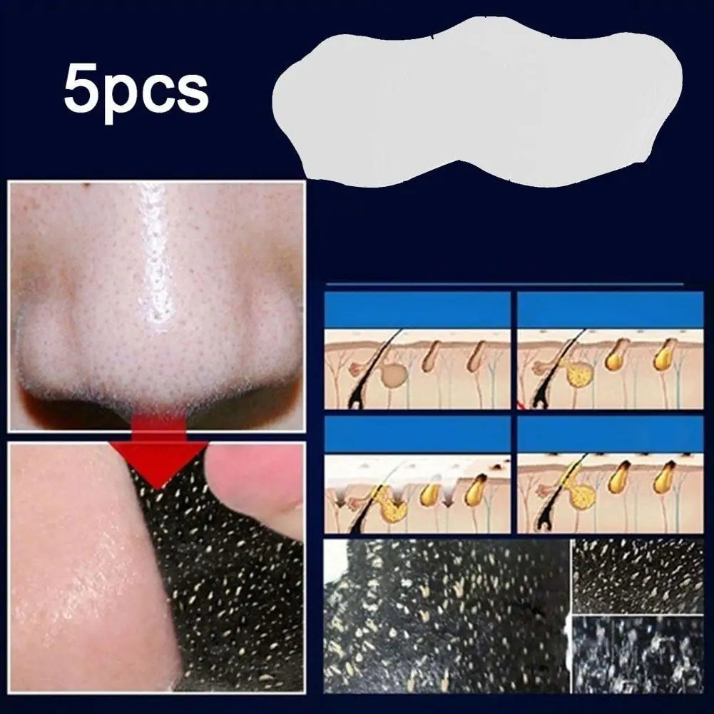 Blackhead Remover Strips